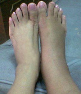 feet