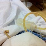 It was Chronic Calculous Cholecystitis with Choledocholithiasis