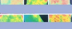 Breast themography results with a naturopathic doctor (Part 2)