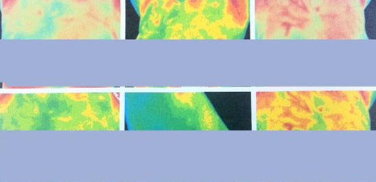 themography results