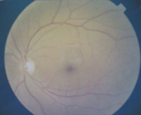 eyeangiogram.jpg