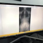 gonstead technique spinal care chiropractic