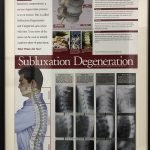 sublixation degeneration at spinal care chiropractic